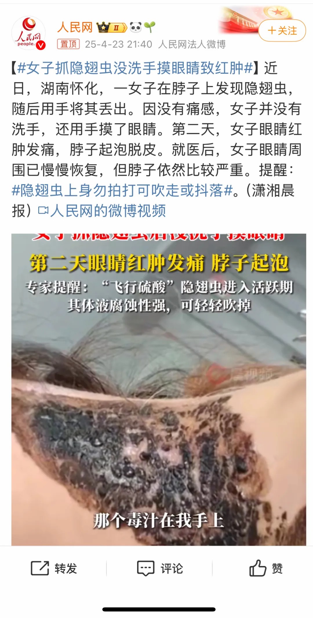 有人因此“毁容”!遇到这种虫子千万不能拍