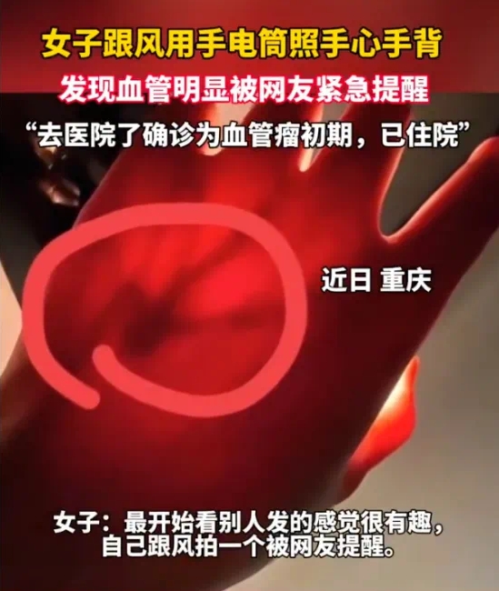 一张照片竟被网友看出血管瘤 身体出现这3个信号要当心